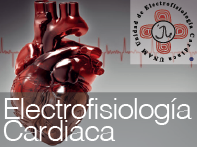 DI_Unidad Electrofisiología Cardiaca